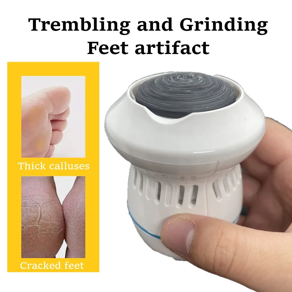 Callus Remover Vacuum